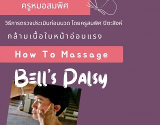 Bell’s Palsy โรคใบหน้าเบี้ยวครึ่งซีก